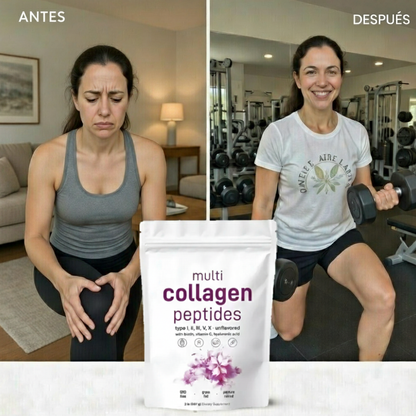 Dile adiós al cabello, piel y uñas muertas con el MULTI COLLAGEN PEPTIDES 5 EN 1 ⭐
